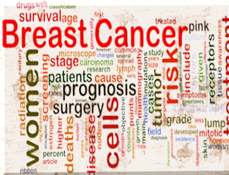 Physical Therapy for Patients with breast cancer